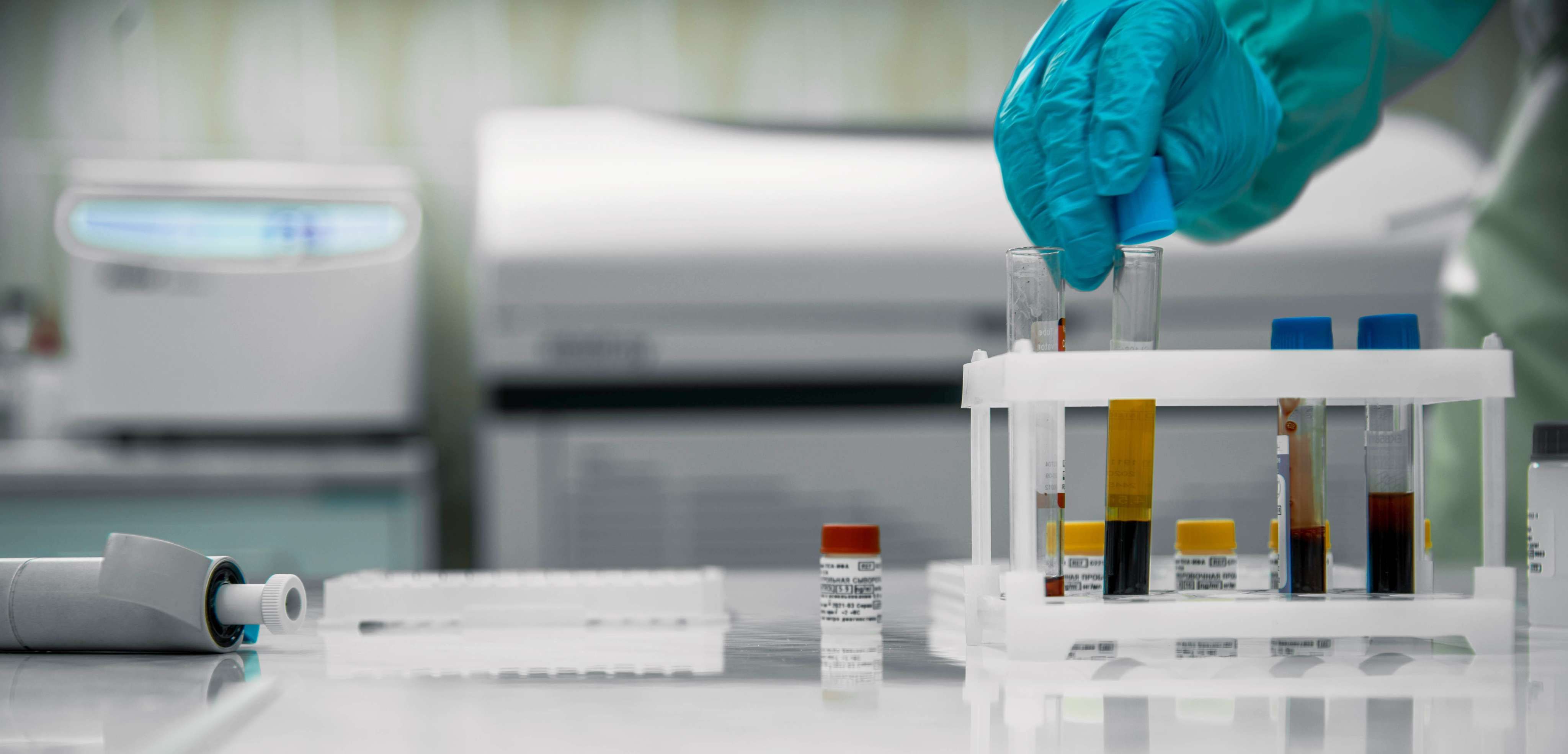 Échantillons sanguins et matériel d'analyse dans un laboratoire médical